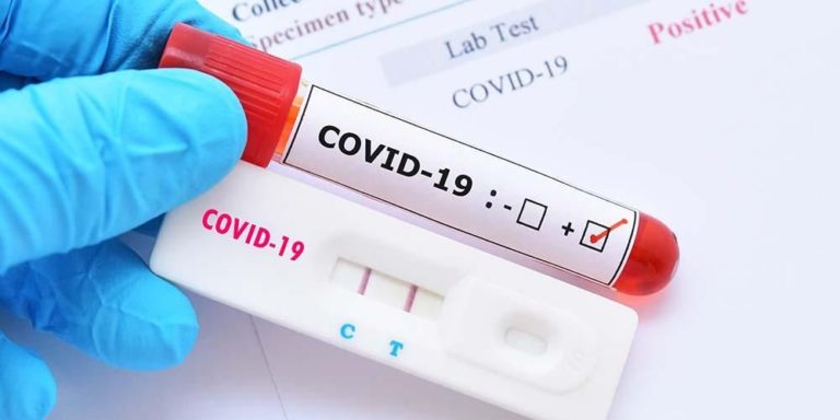 Memahami Perbedaan Rapid Test Antibodi, Rapid Antigen, dan PCR Untuk Deteksi Covid-19