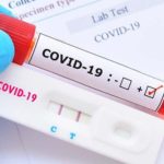 Memahami Perbedaan Rapid Test Antibodi, Rapid Antigen, dan PCR Untuk Deteksi Covid-19
